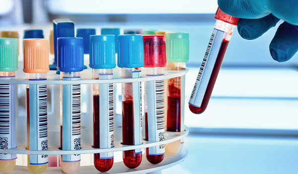 Norweska firma SERO AS specjalizuje się w produkcji materiałów odniesienia obejmujących testy immunologiczne, a także materiały wykorzystywane w badaniach klinicznych, do analizy lipidów, hormonów, białek, markerów nowotworowych, pierwiastków śladowych oraz leków. 